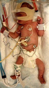 Morgan after being inducted into the NICU